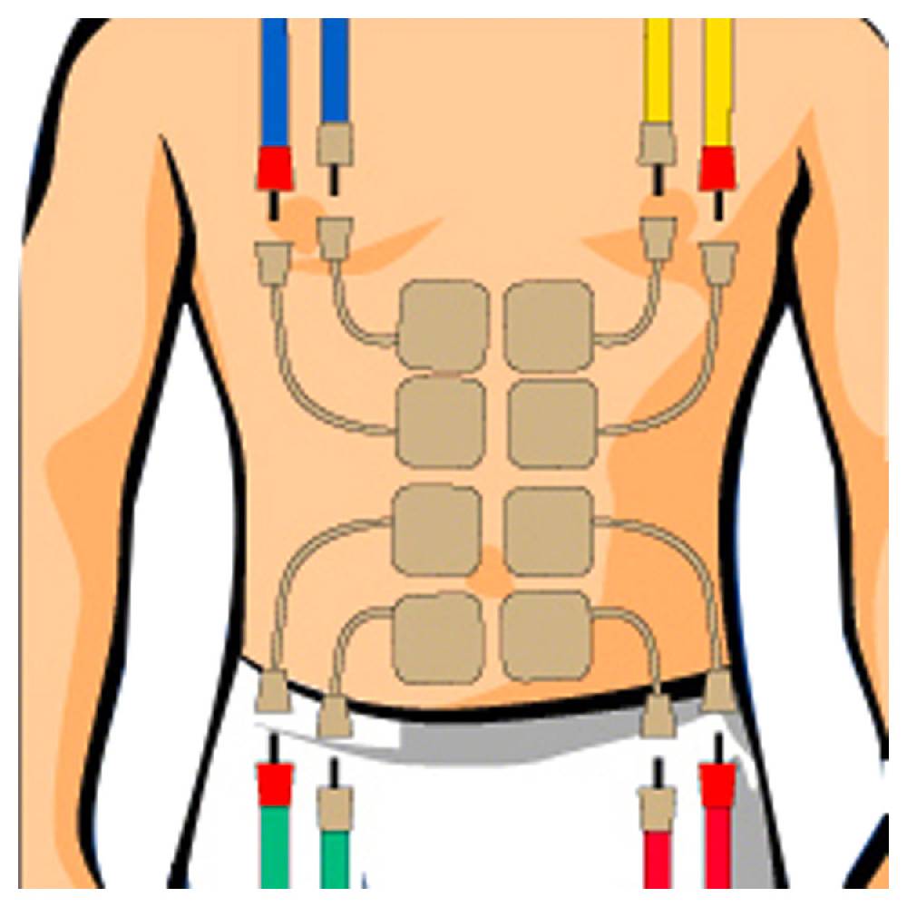 Sport Tec Compex Elektroden Wire, 5x5 cm, 4 Stück Versandkostenfrei