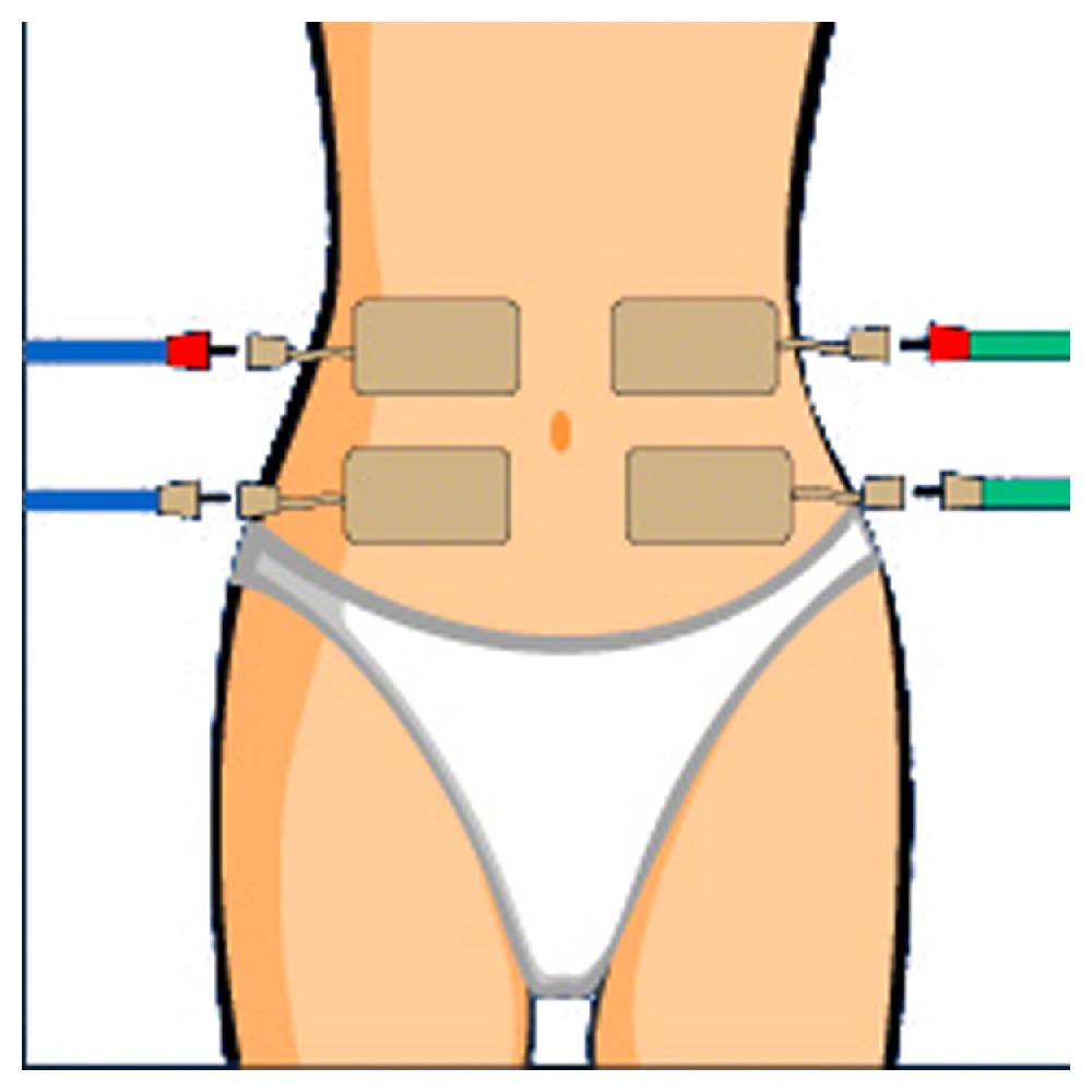Sport Tec Compex Elektroden Wire, 5x10 cm, 2 Stück Großer Ausverkauf