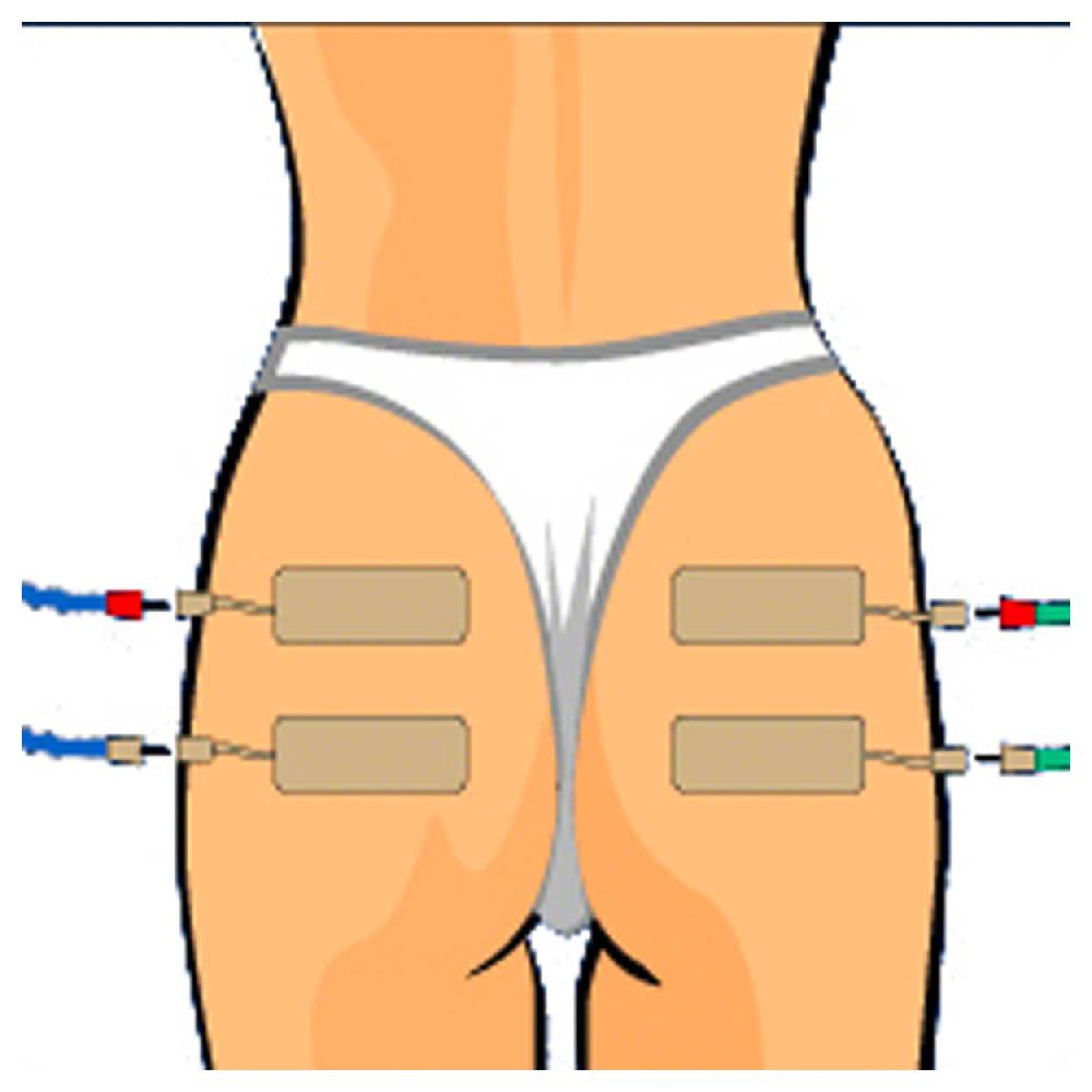 Sport Tec Compex Elektroden Wire, 5x10 cm, 2 Stück Großer Ausverkauf