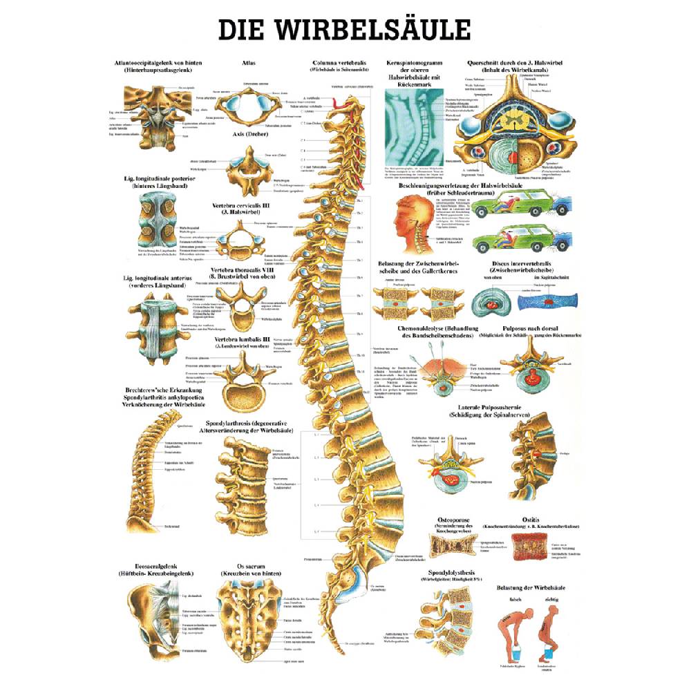 Sport Tec Mini-Poster "Wirbelsäule", LxB 34x24 cm Top Angebot
