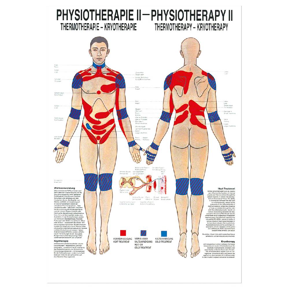 Sport Tec Mini-Poster "Thermotherapie", LxB 34x24 cm