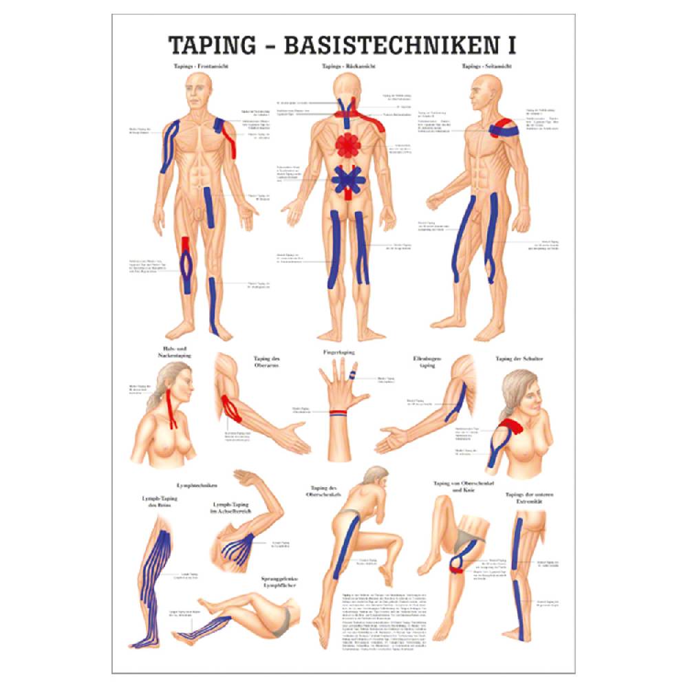 Sport Tec Mini-Poster "Taping- Basistechniken I", LxB 34x24 cm Nur noch ein Tag übrig