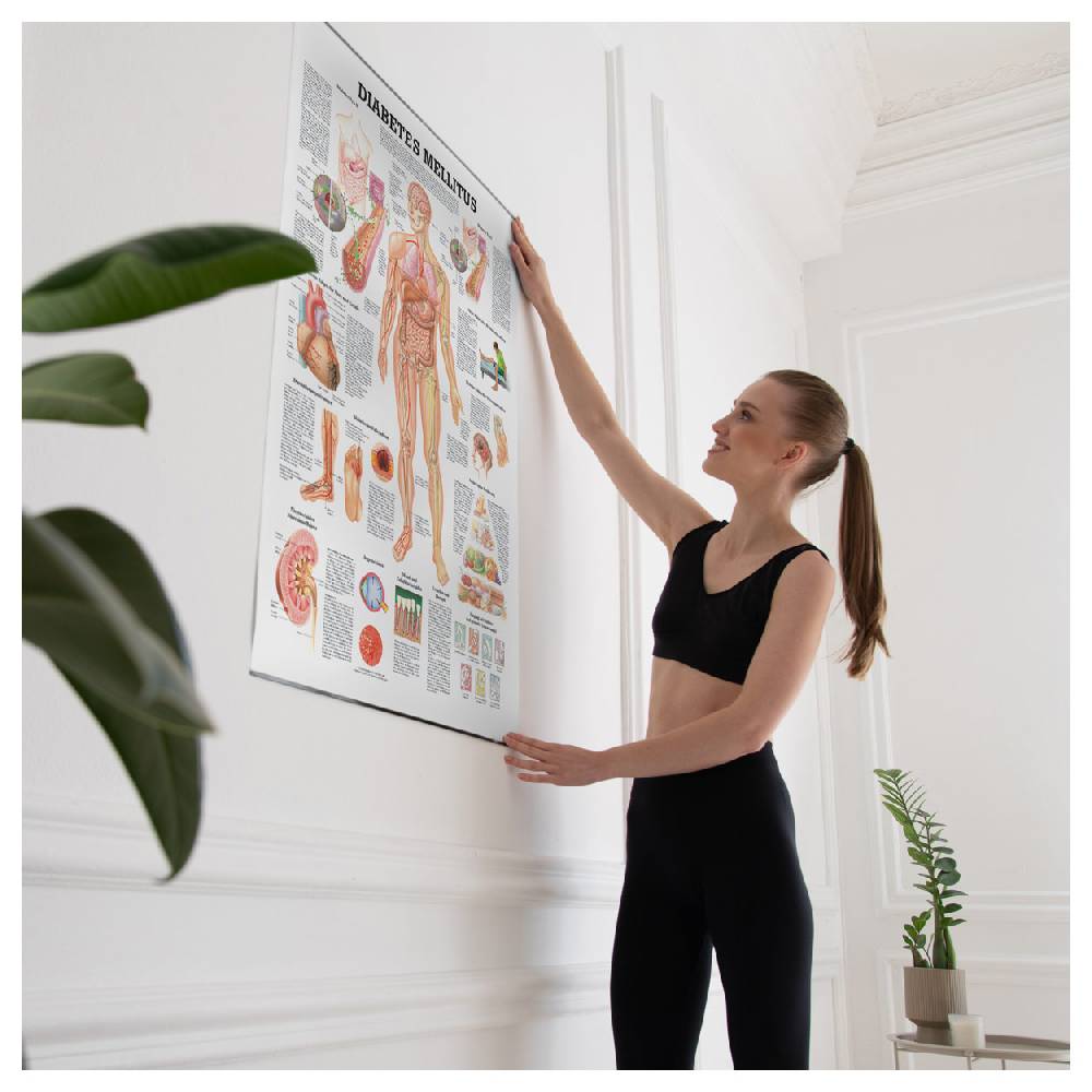 Sport Tec Lehrtafel "Diabetes Mellitus", LxB 100x70 cm Schlussverkauf
