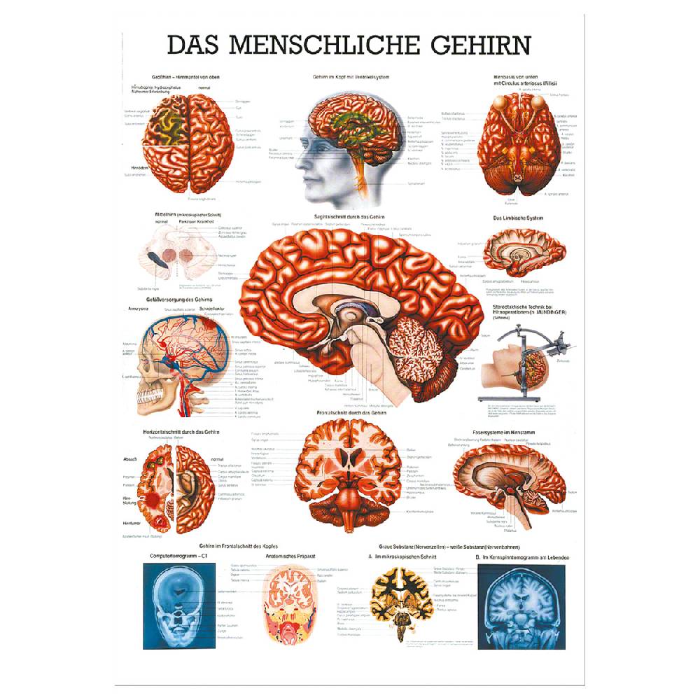 Sport Tec Lehrtafel "Das Gehirn", LxB 100x70 cm Sonderangebote