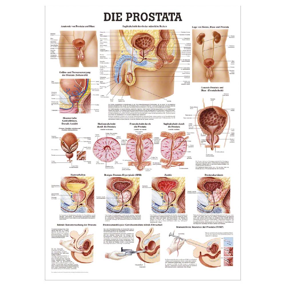 Sport Tec Lehrtafel "Die Prostata" LxB 100x70 cm